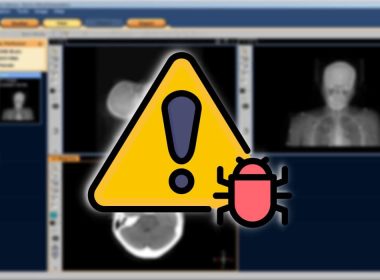 Silver Fox APT Hides ValleyRAT in Trojanized Medical Imaging Software