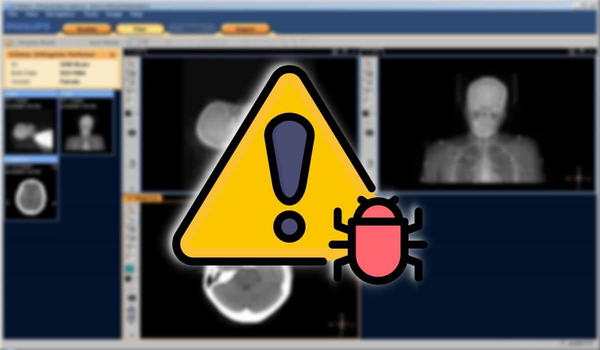 Silver Fox APT Hides ValleyRAT in Trojanized Medical Imaging Software