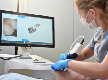 Godent Rolls Out Scanner-as-a-Service Model to Drive Digital Transformation in European Dentistry